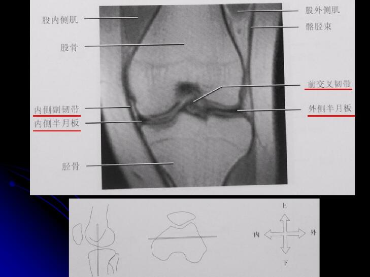 最全膝关节解剖及mri诊断技巧