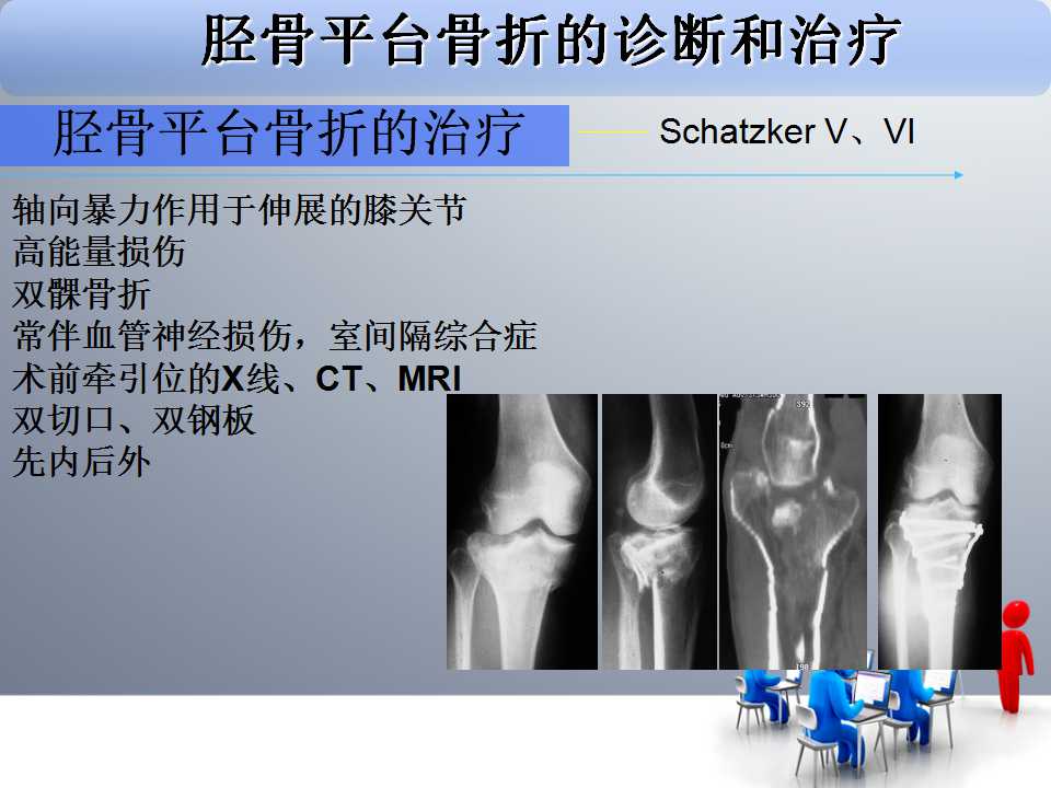 胫骨平台骨折的诊断与治疗技巧