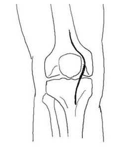 这份膝关节手绘图谱你一定不能错过