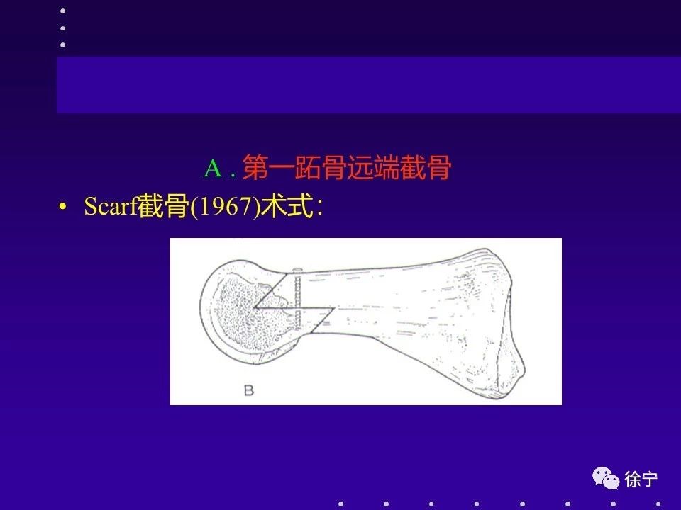 拇外翻的手术治疗技巧全在这篇文章里