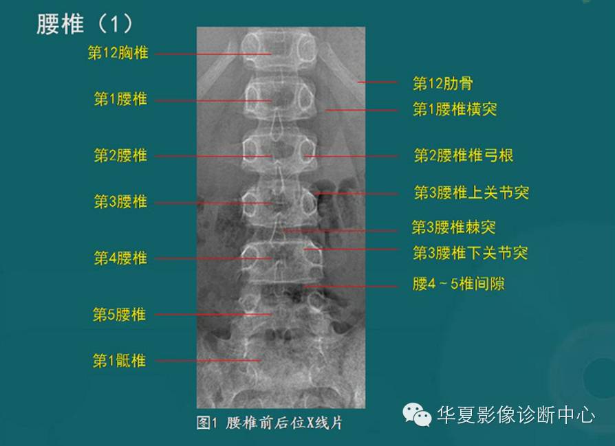 脊柱检查之x线、ct、mri影像解剖 好医术早读文章 好医术 赋能医生守护生命