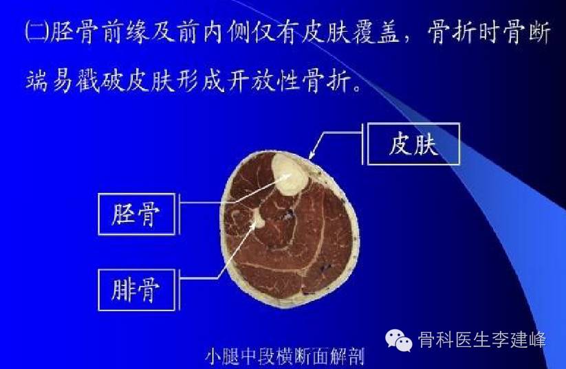 胫腓骨骨折的治疗方法 - 好医术早读文章 - 好医术-赋能医生守护生命