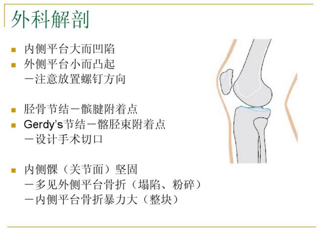 胫骨平台骨折的诊断与治疗 好医术早读文章 好医术 赋能医生守护生命