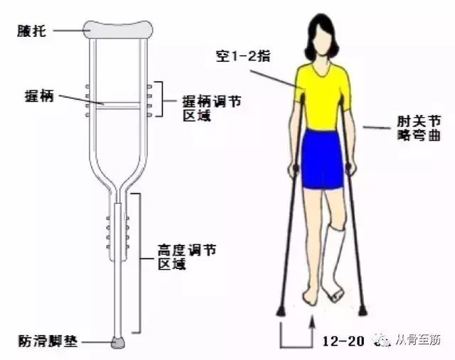 单拐,拄患侧还是健侧?这是个问题