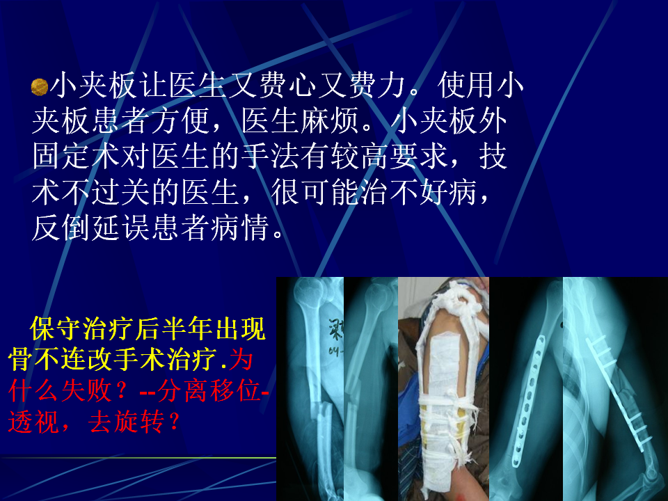 作者介绍:许树柴主任医师,医学博士省中医院二沙岛分院骨科主任,广州