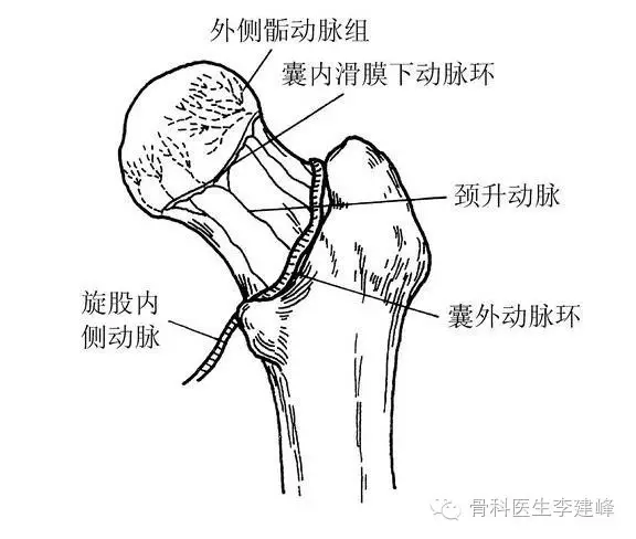 1,直接損傷:跌倒股骨大轉子著地,或下肢暴力外旋使骨質不良的股骨頸