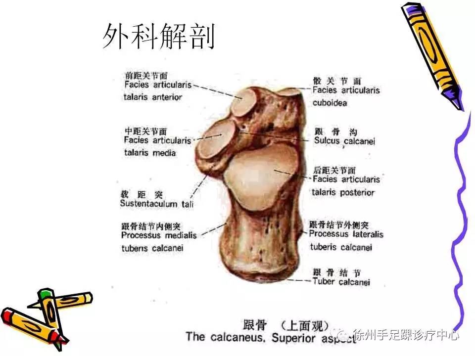 跟骨骨折的诊断及治疗策略