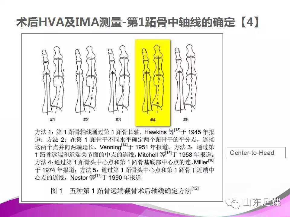 拇外翻x線測量評估及術式選擇