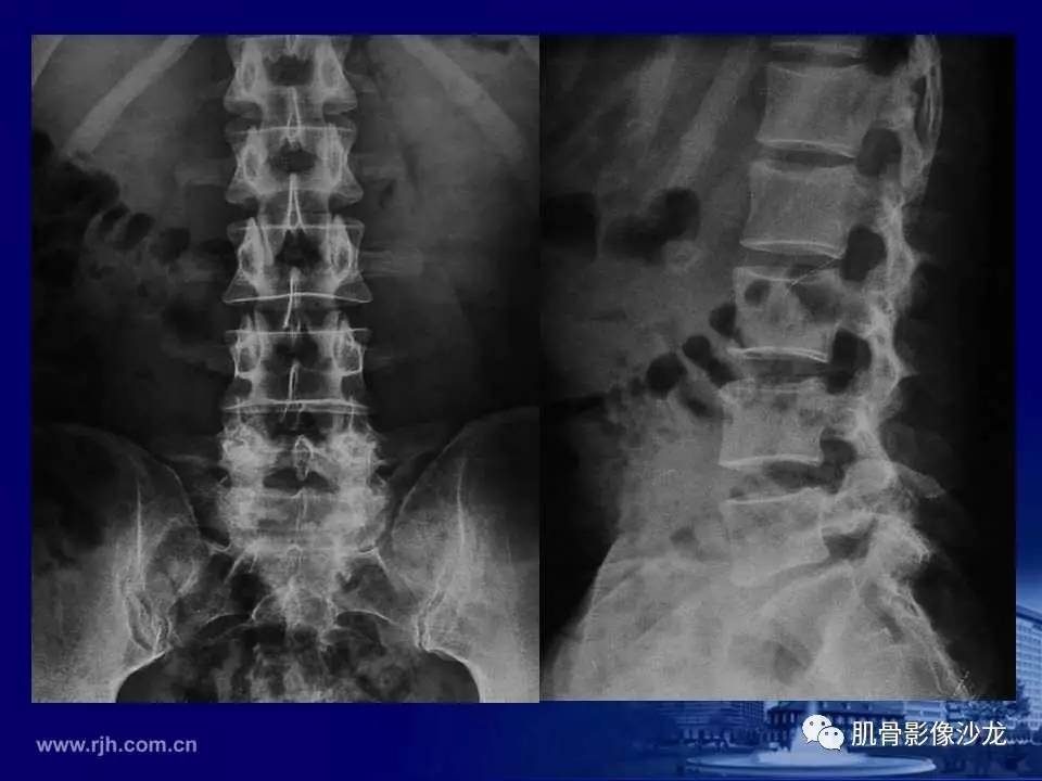 医師の診察を受ける
