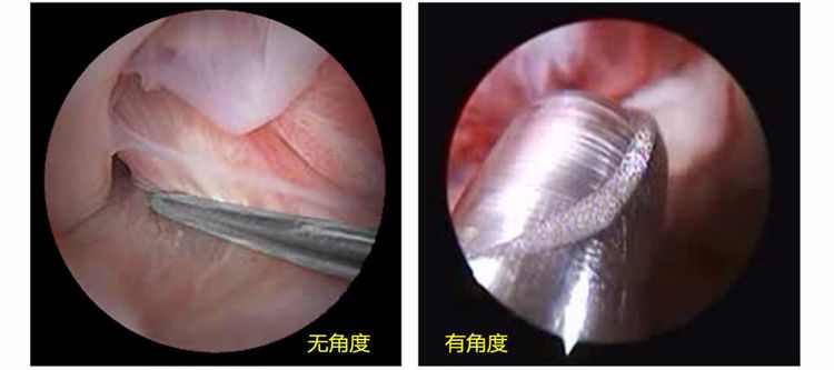关节镜的基本知识详解