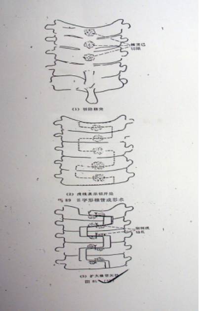 颈椎病的临床诊治策略