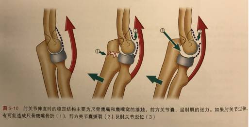 肱骨远端骨折的临床诊治要点