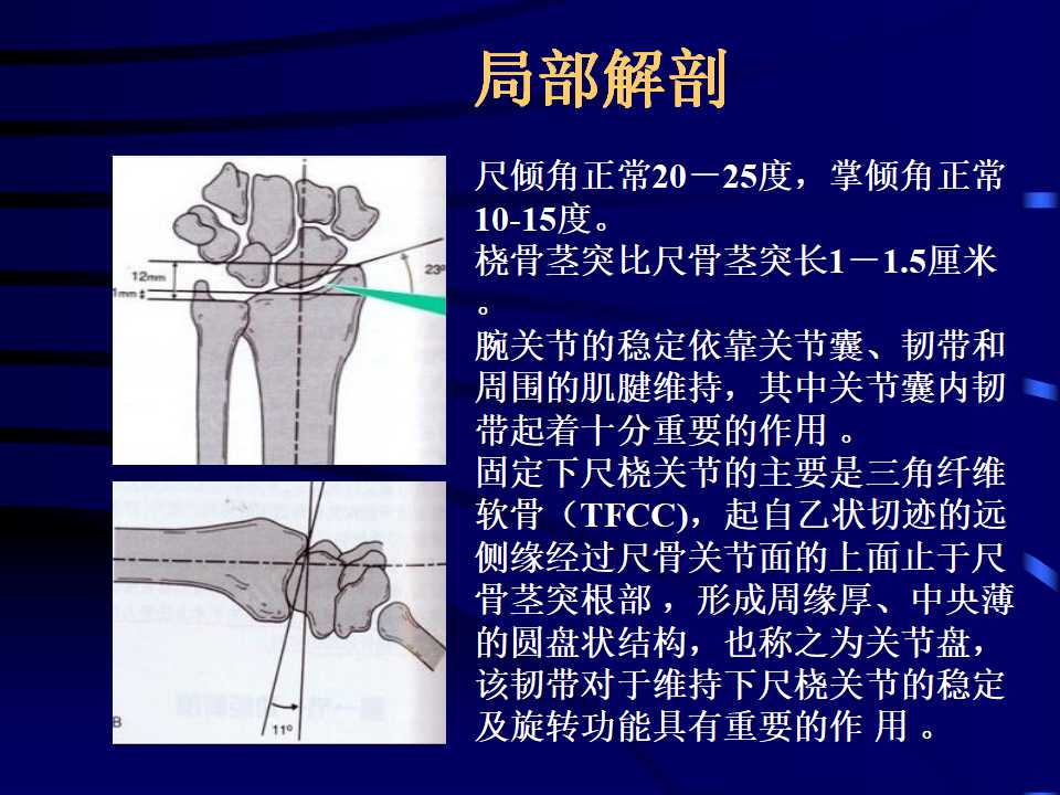 桡骨远端骨折的临床诊治策略