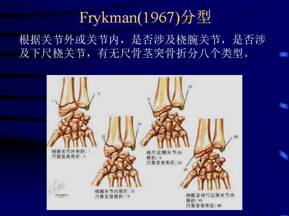 桡骨远端骨折的临床诊治策略