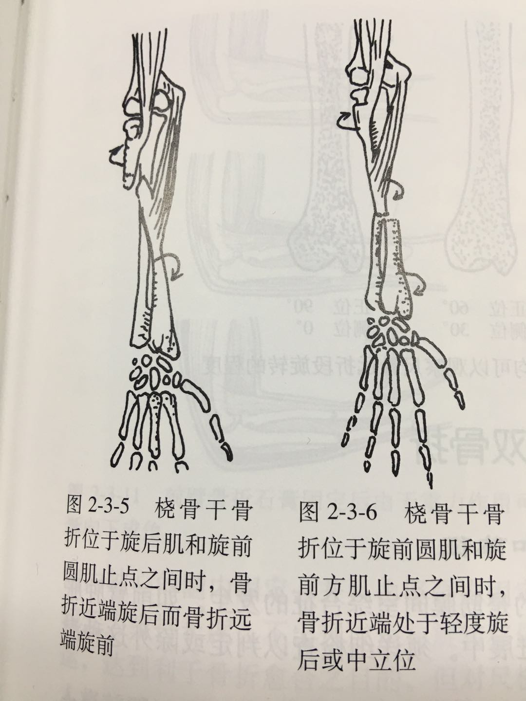 文章详情
