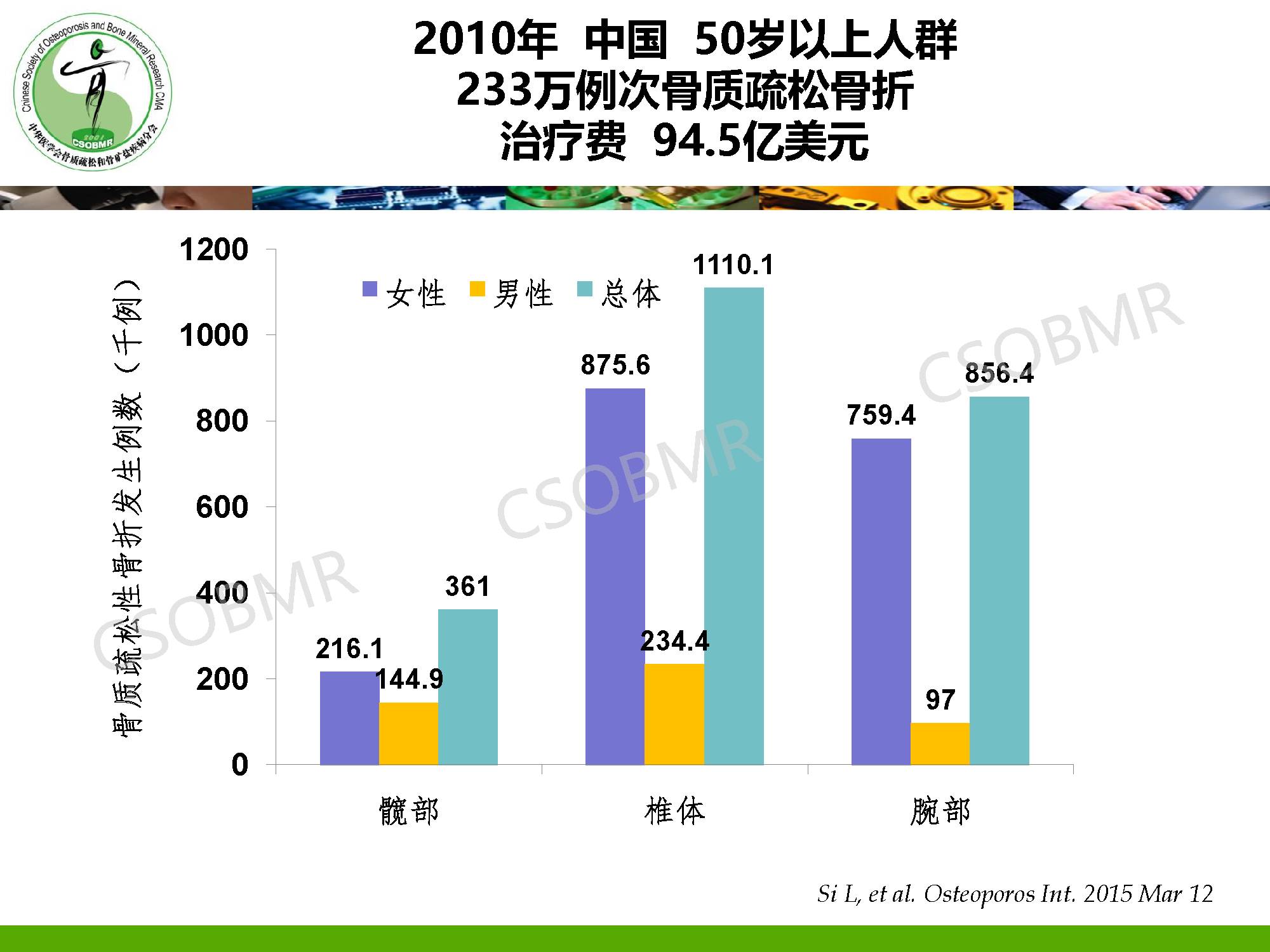 骨质疏松的症状 (骨质疏松的症状有哪些)