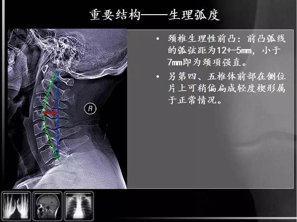 颈椎x线解剖图高清图片