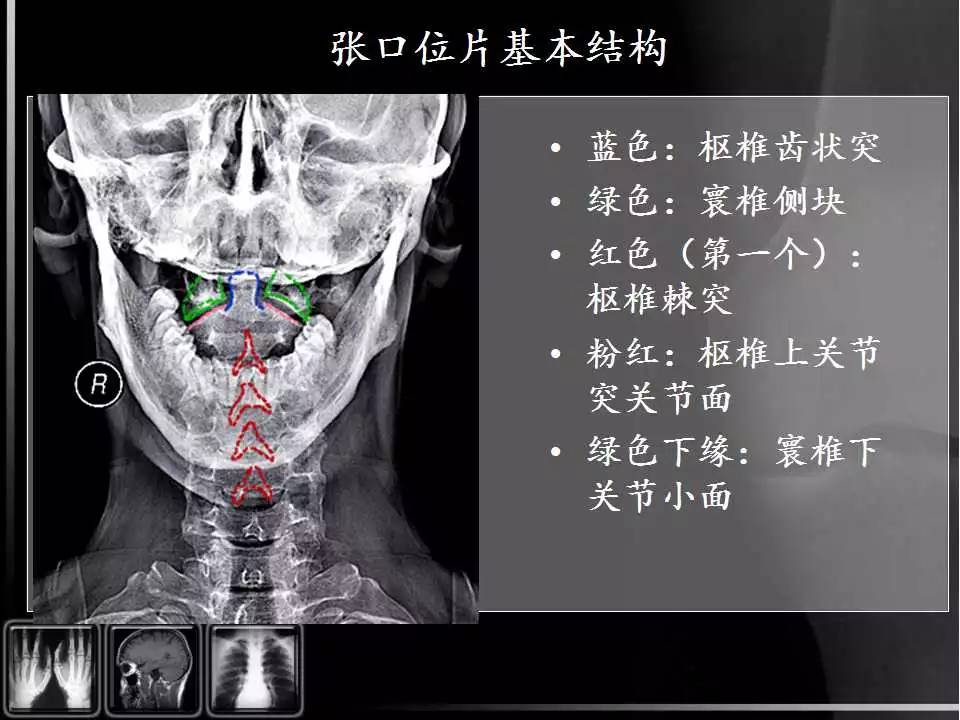 颈椎x线解剖图高清图片