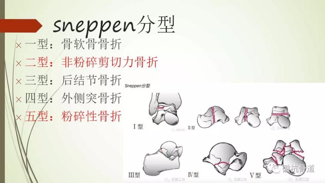 距骨骨折的分型及临床治疗策略