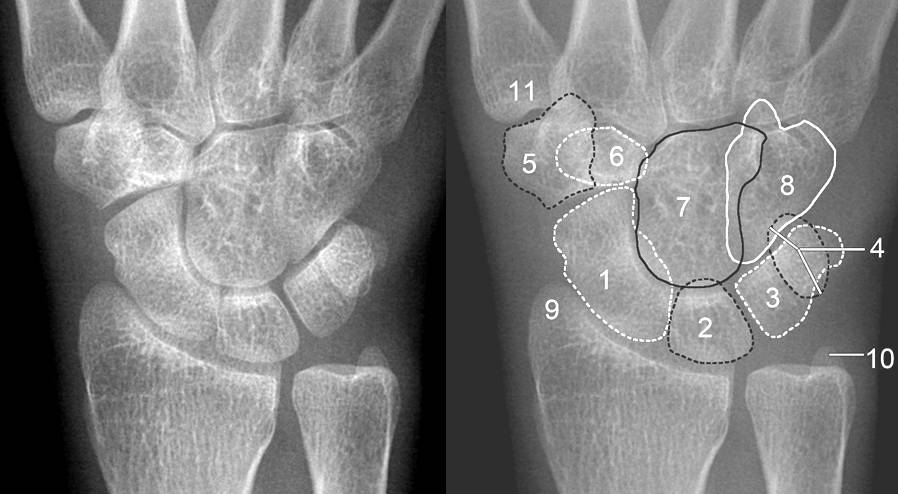 治るまでどれくらいかかりますか?