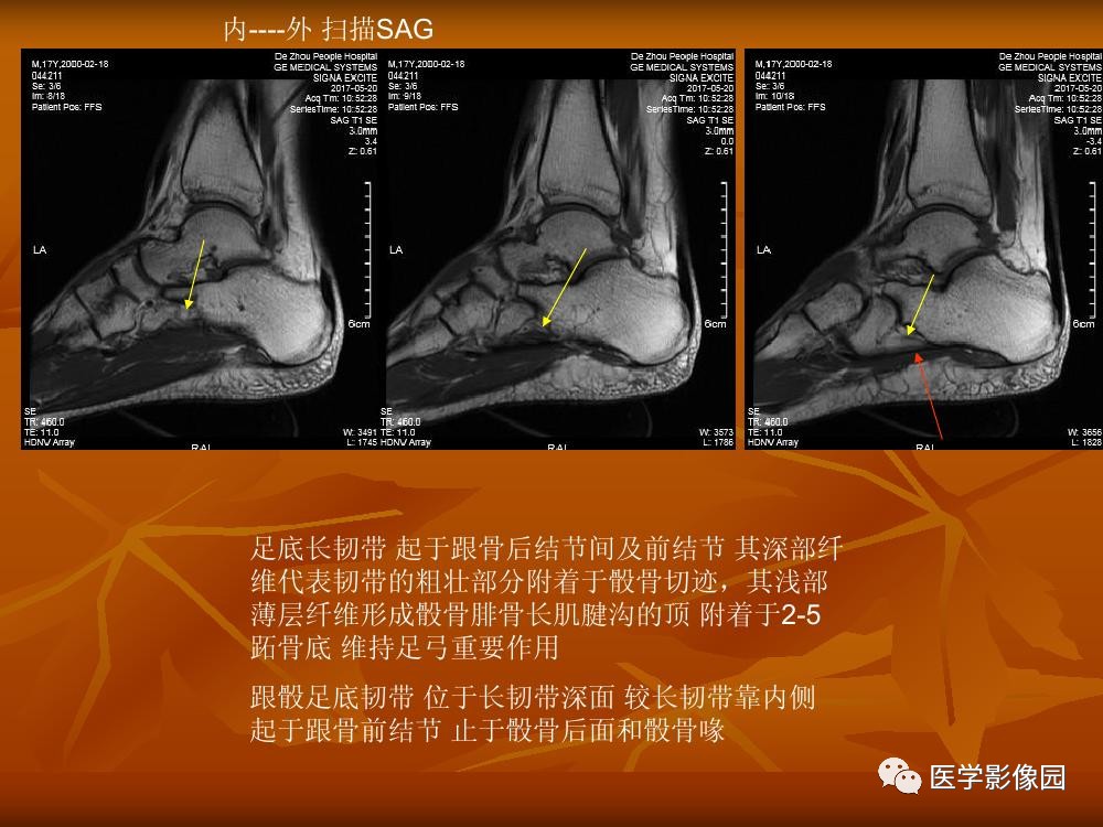 踝關節韌帶的解剖及影像表現