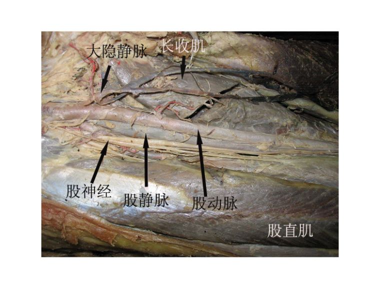 骨科解剖及手術切口入路詳解