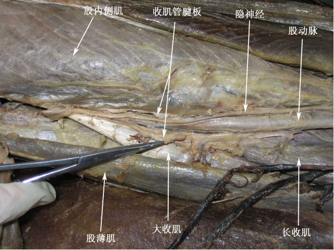管前壁为一腱板,上口通股三角尖,下口为收肌腱裂孔.