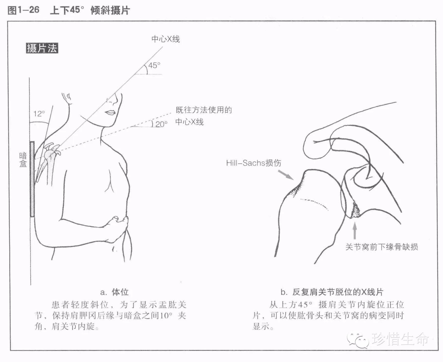肩关节x线检查体位大全