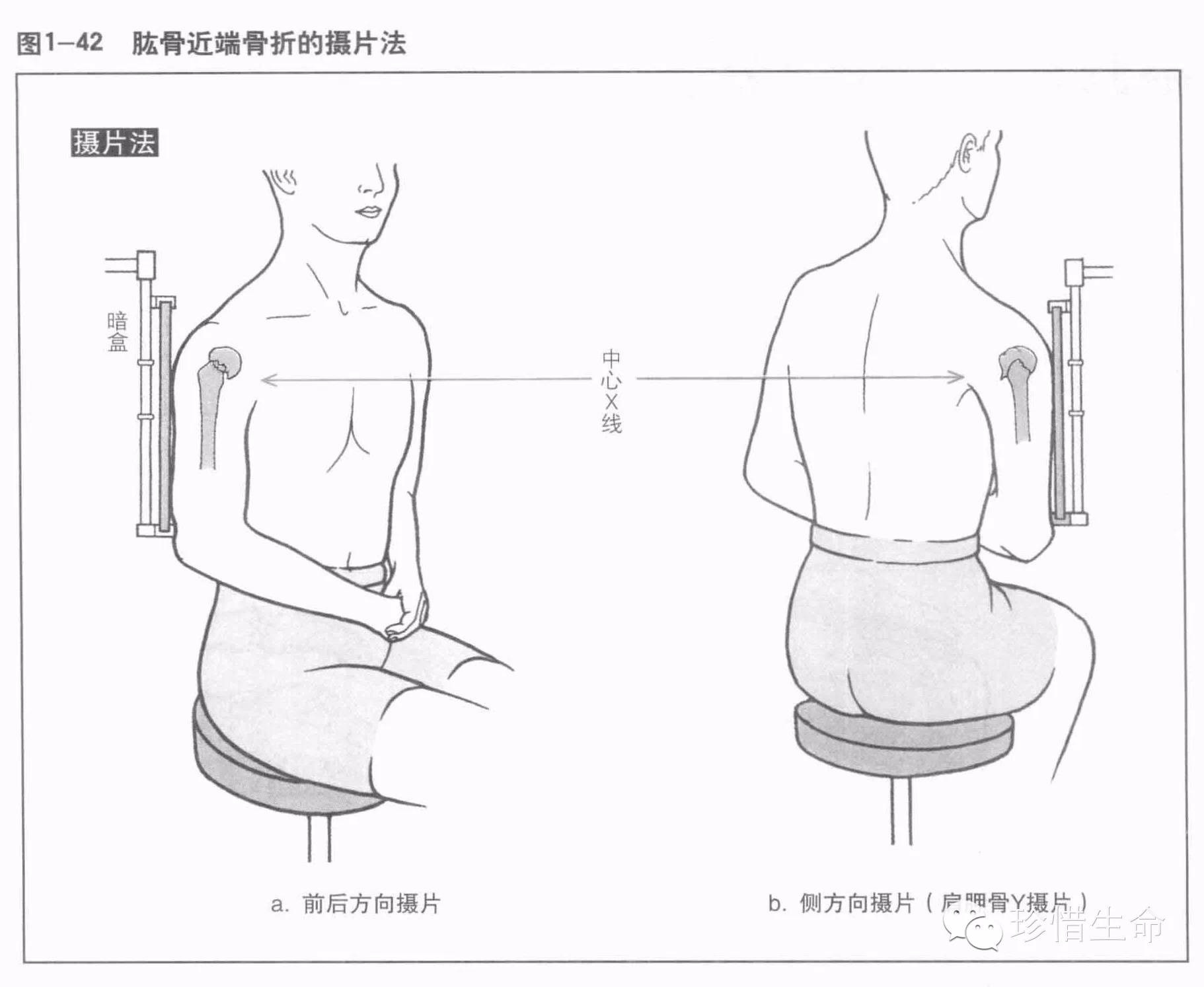 肩关节x线检查体位大全