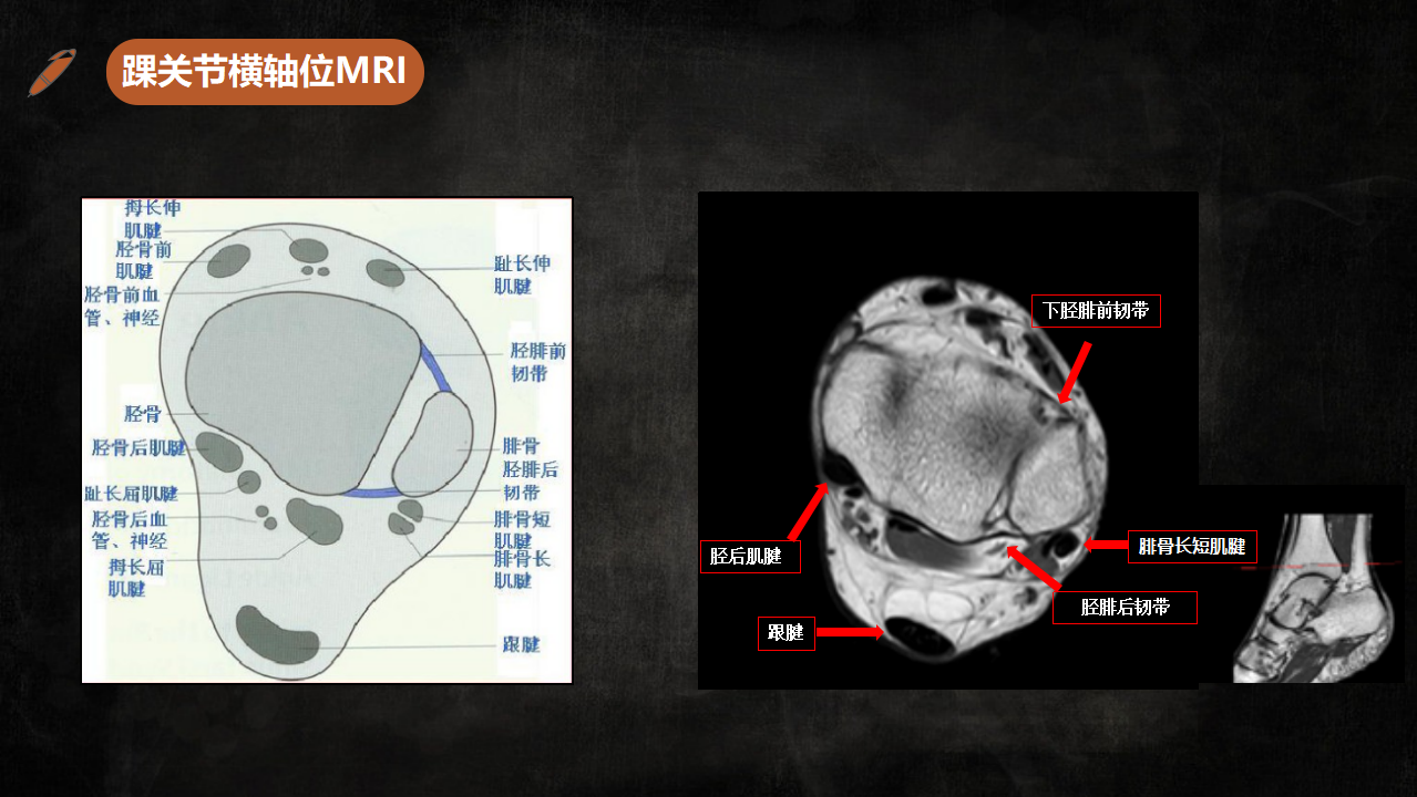 足踝部解剖及影像學診斷基礎必備