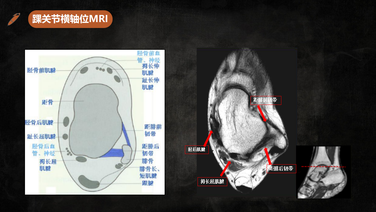 足踝部解剖及影像學診斷基礎必備