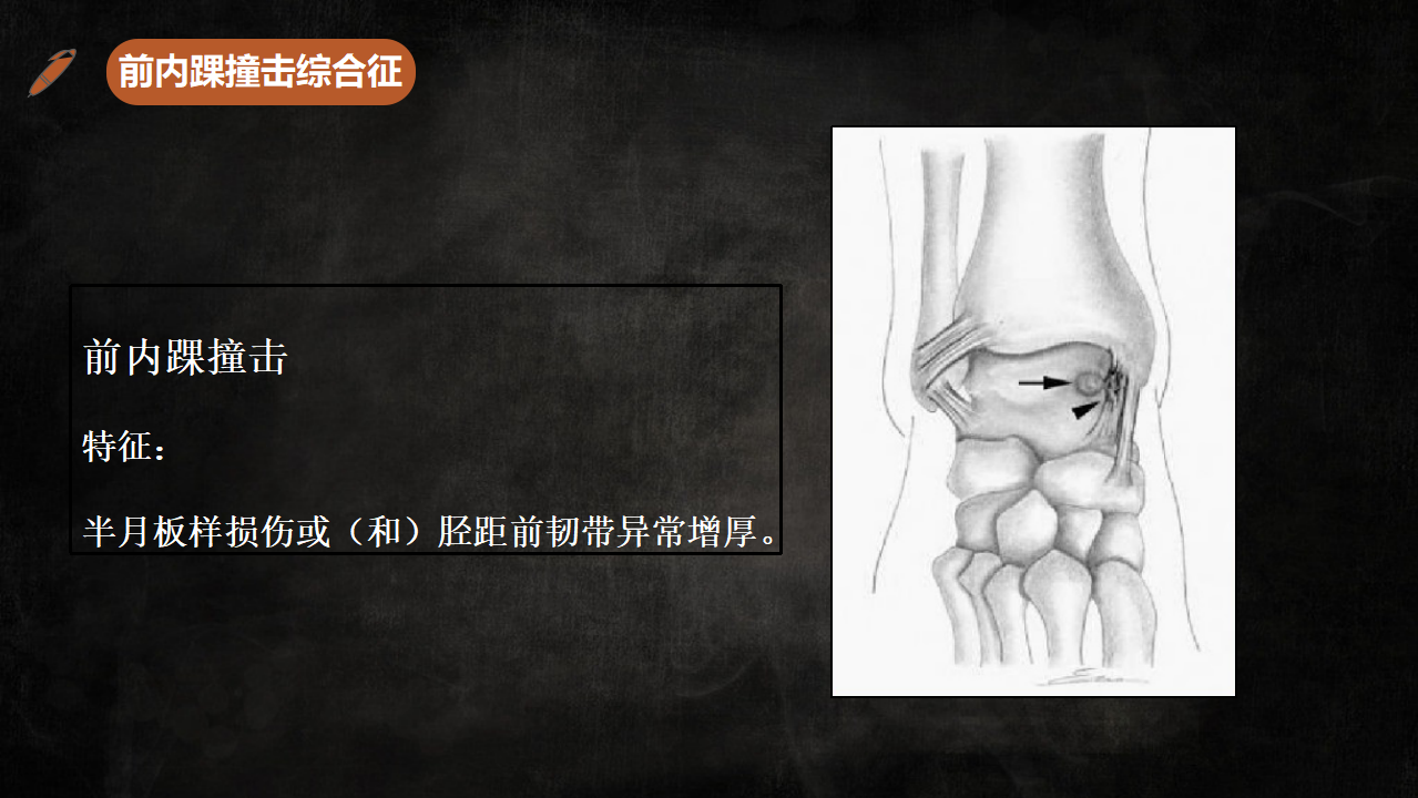 足踝部解剖及影像學診斷基礎必備