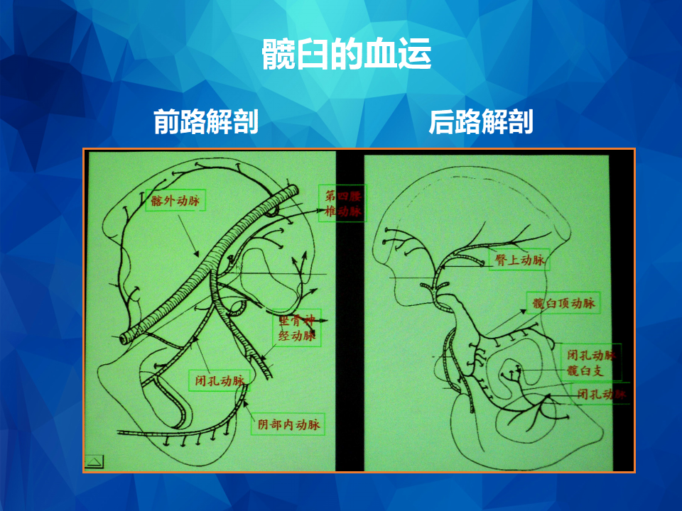 stoppa及其改良入路治疗骨盆髋臼骨折