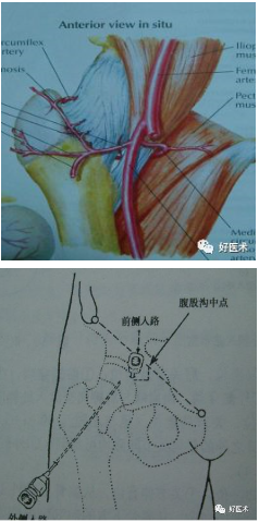 各關節腔穿刺技巧大全,趕緊收藏備用!