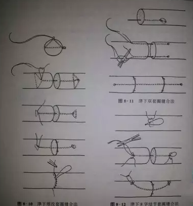 肌腱缝合术的原则及方法