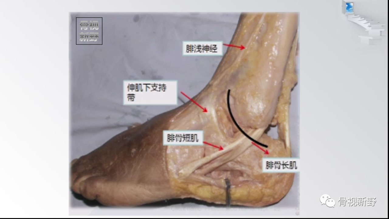 踝关节解剖高清图解,值得收藏!