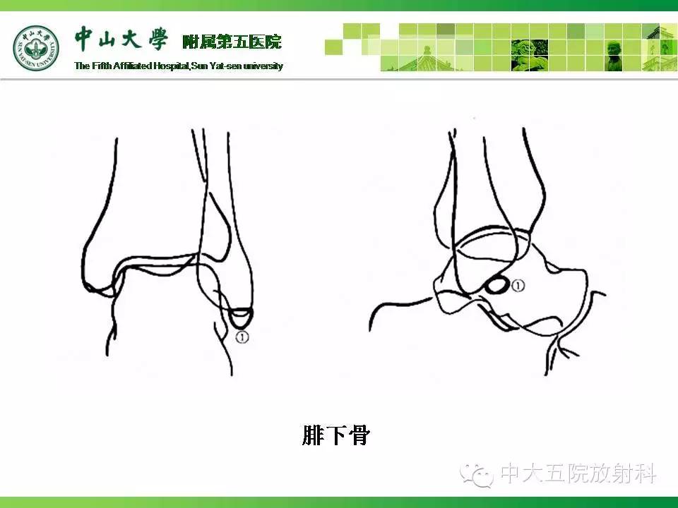 史上最全:骨關節的各種病變影像,都在這裡了