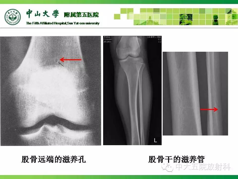 史上最全:骨關節的各種病變影像,都在這裡了