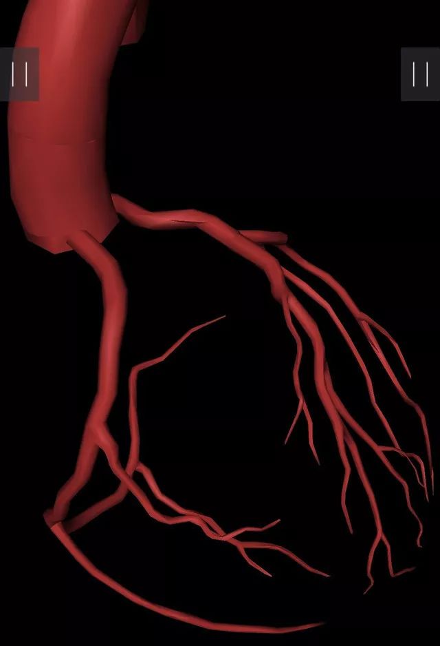 左前斜位:lao45°可以充分显示右冠状动脉头部,体部,右冠状动脉呈"c"
