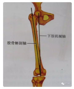 下肢力線測量方法最全彙總,趕緊收藏備用!