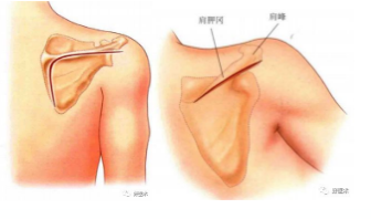 在岡下肌和小圓肌之間分離後,將岡下肌向上牽開,注意保護肩胛上神經