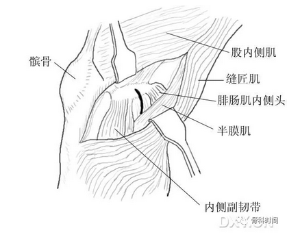 这份膝关节手绘图谱你一定不能错过