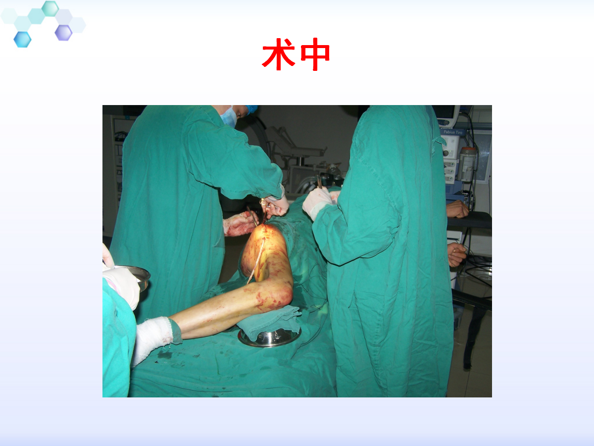 内容包括侧卧位手术的优势,术中注意