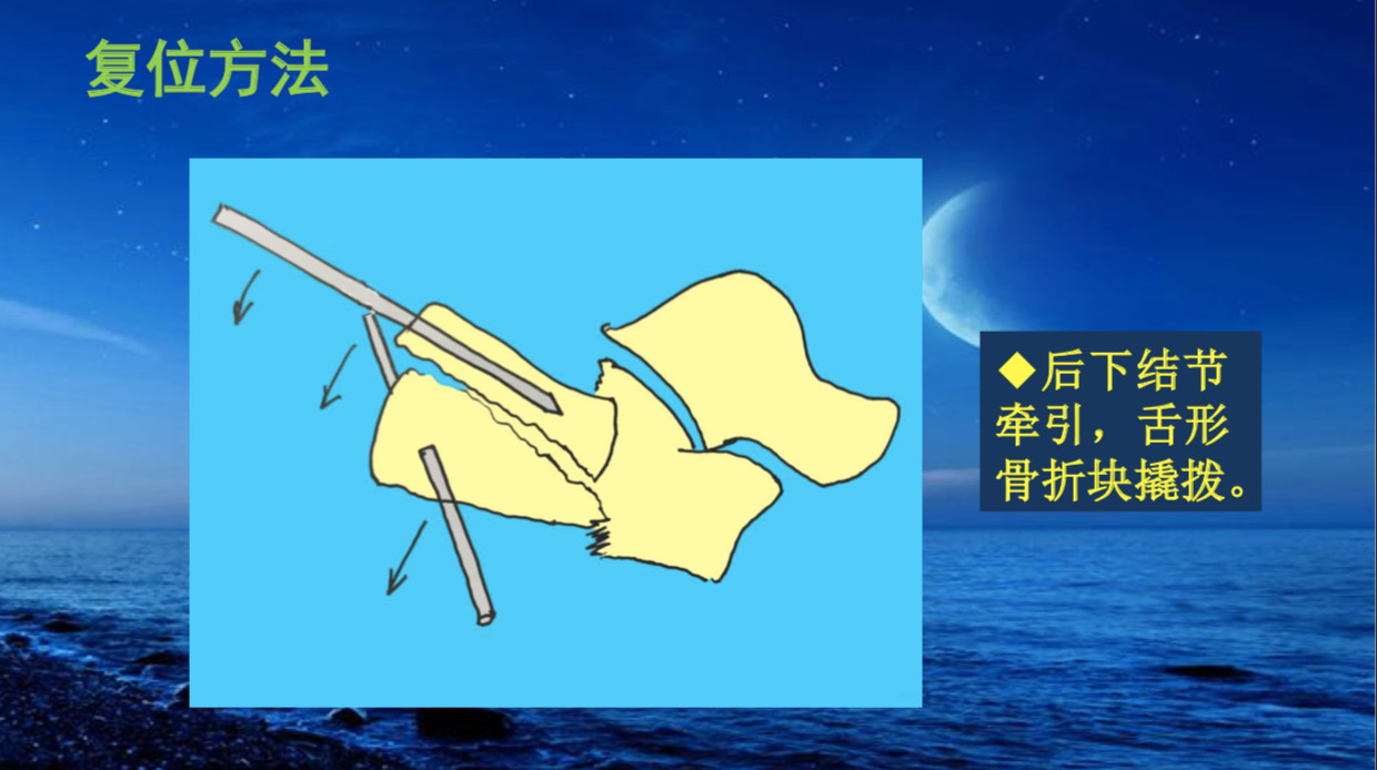 看完这篇你就会啦