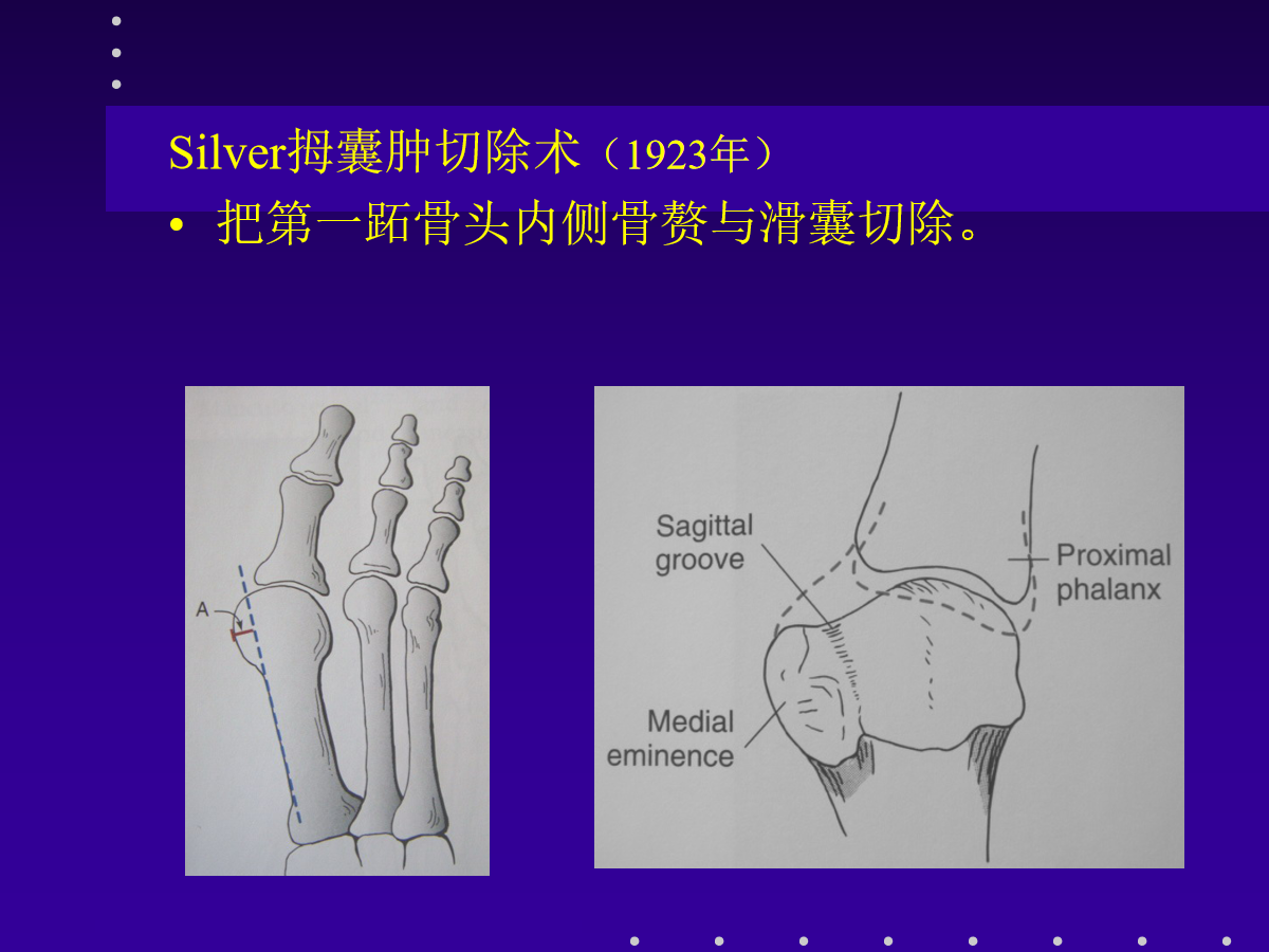 足拇长伸肌腱解剖图-千图网