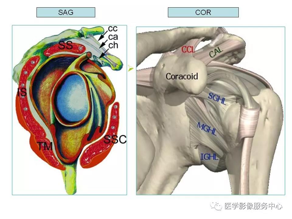 肩關節韌帶及損傷的mr表現,都在這裡了!