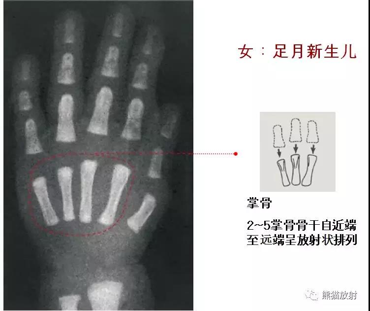 值得收藏的骨齡圖譜!方便隨時對照!