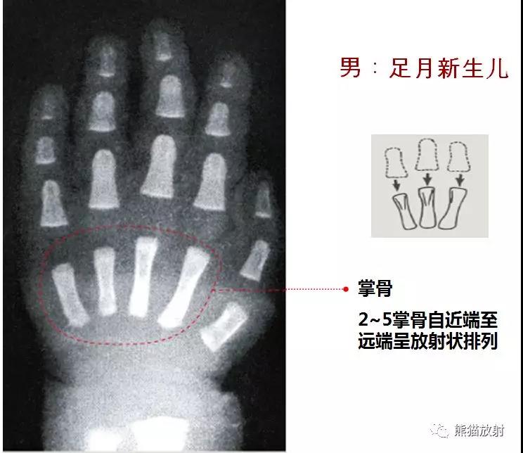 值得收藏的骨齡圖譜!方便隨時對照!