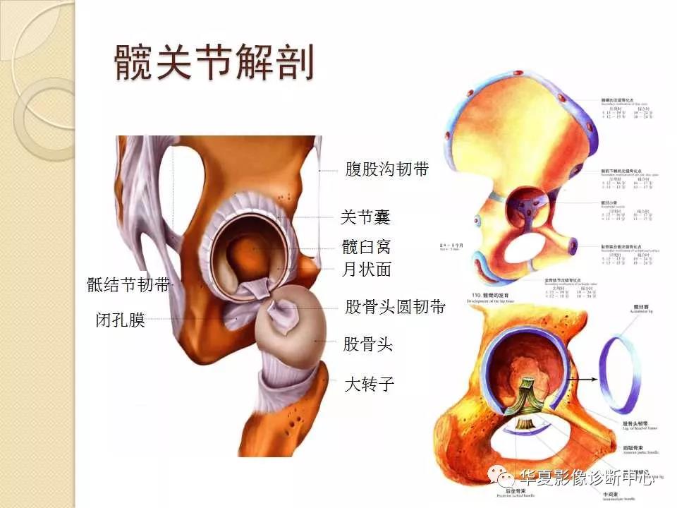 髖關節解剖及常見疾病的mri診斷,都在這裡了!